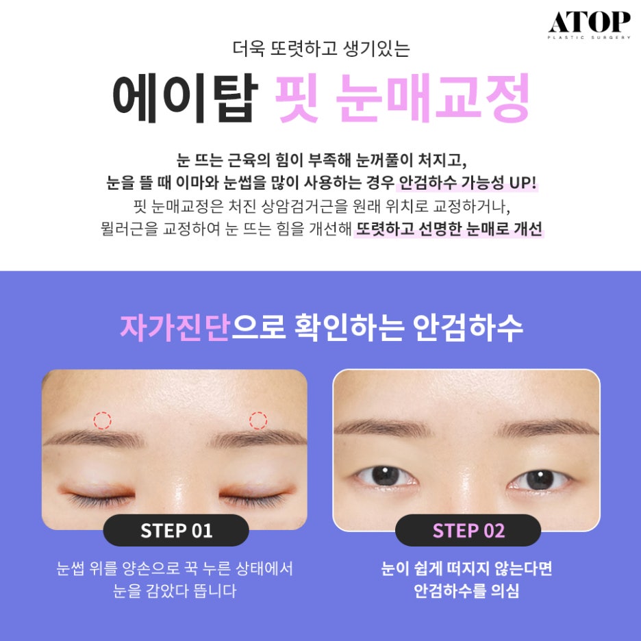 Natural Adhesion Double Eyelid Review: Confidence Boosted with a Face-Fitting Procedure image 5