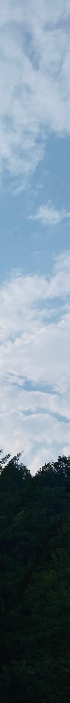 중년눈밑지방 눈꺼풀이 계속 처진다면? 관련 이미지 27