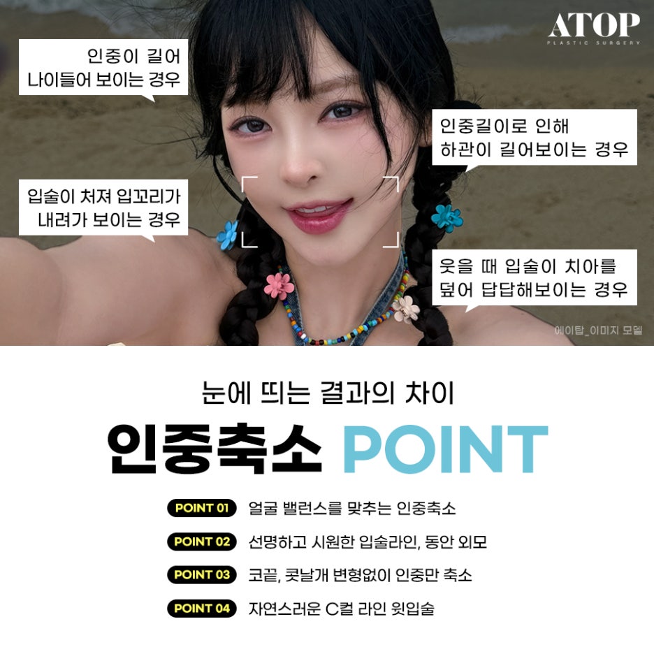 인중축소수술후기 최대 줄일 수 있는 길이는? 관련 이미지 5