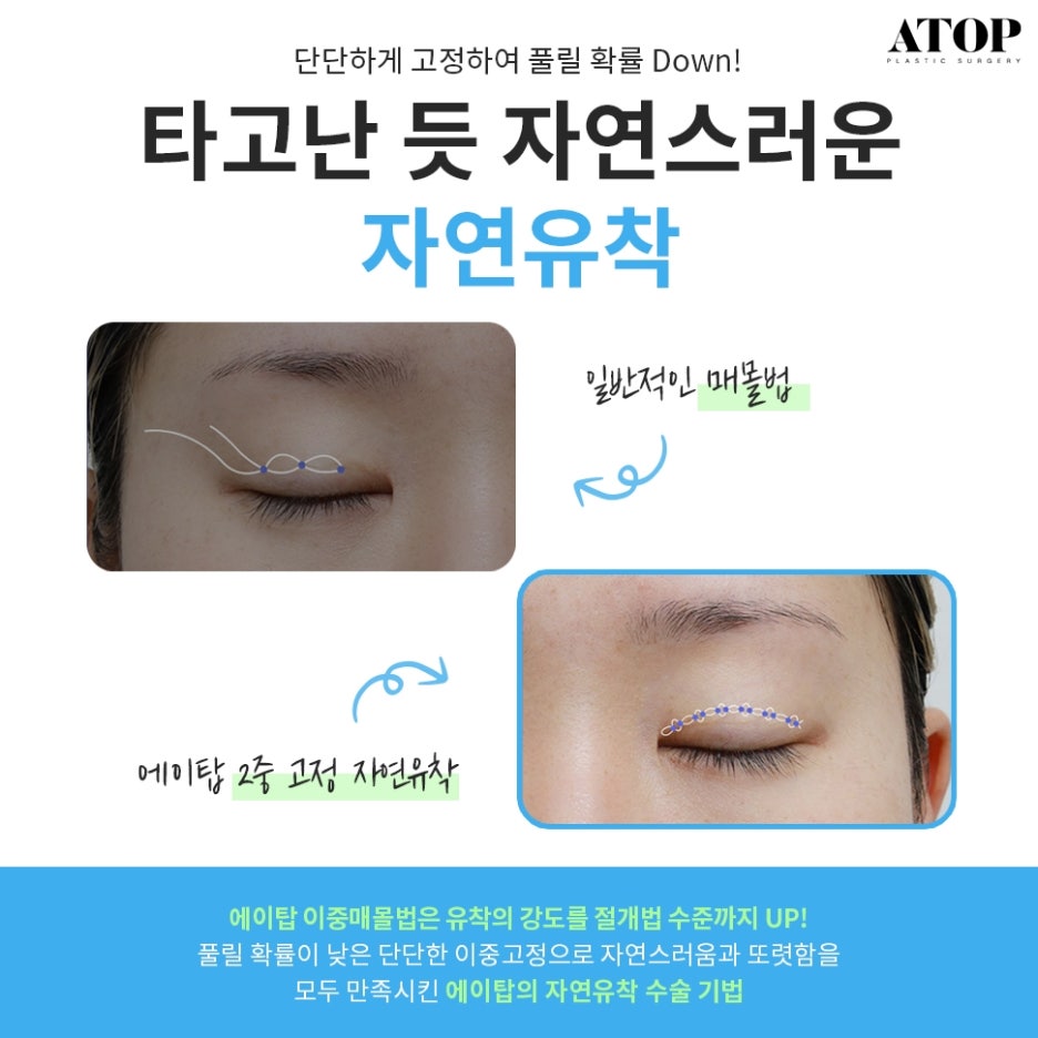 세미아웃라인자연유착 화려함과 자연스러움을 함께 관련 이미지 2
