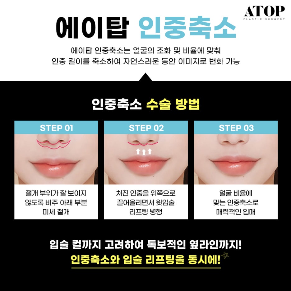 인중축소수술후기 최대 줄일 수 있는 길이는? 관련 이미지 2