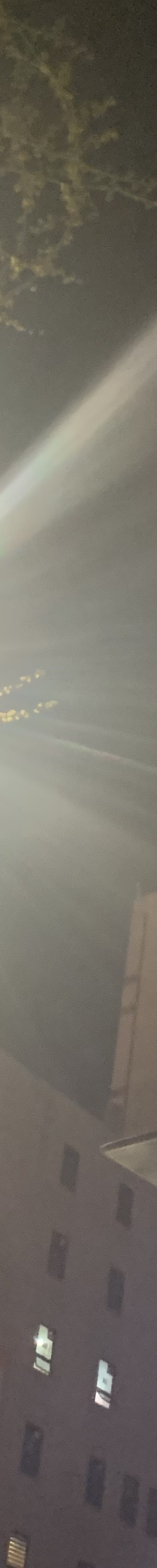 인중축소수술후기 최대 줄일 수 있는 길이는? 관련 이미지 13