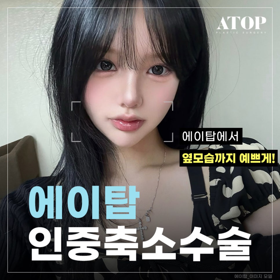 Looking Younger with a Reduction That Matches the Proportions: Philtrum Reduction Surgery Cost image 1