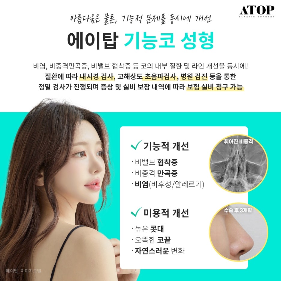 매부리코성형후기 차이나는 이유 관련 이미지 4