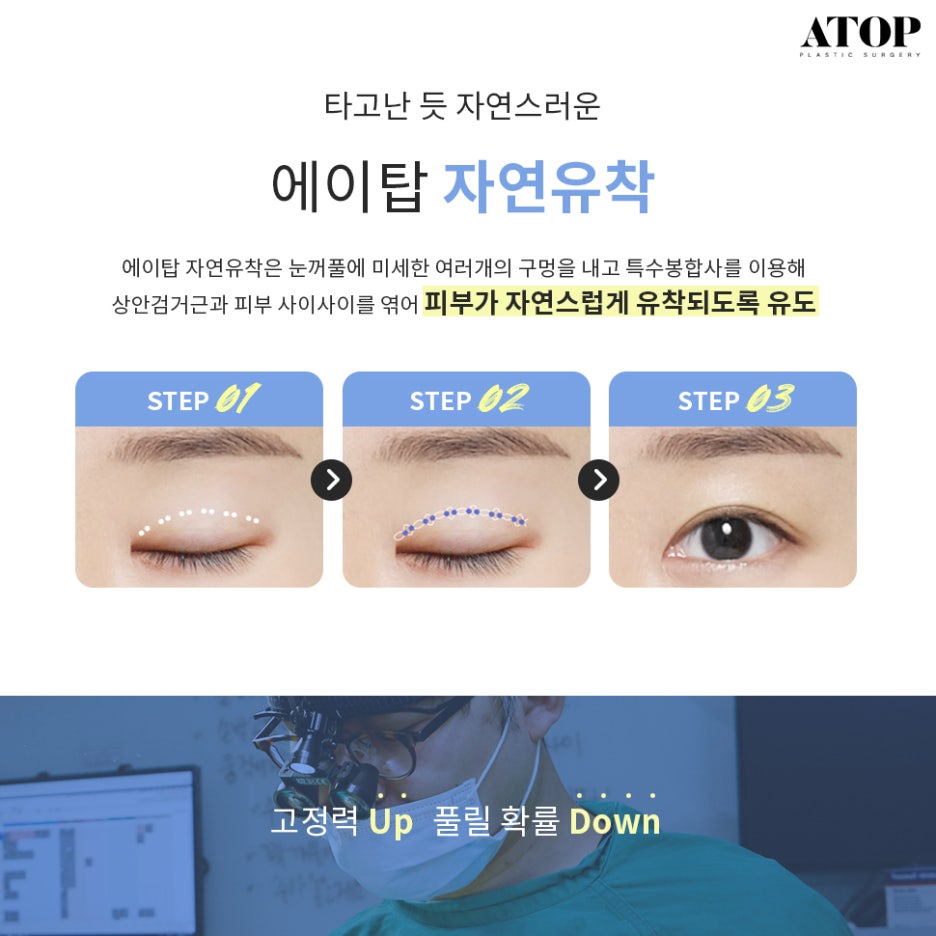 강남쌍수잘하는곳 맞춤 디자인으로 핏하게 관련 이미지 3