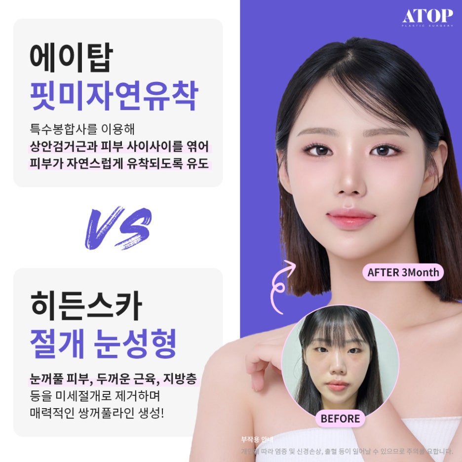 연예인성형외과 이목구비부터 얼굴형까지 부드러운 개선 관련 이미지 5