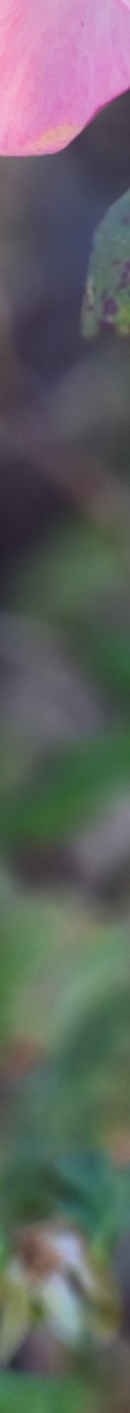 인중축소후기 비율에 맞는 예쁜 입술라인을 위해 관련 이미지 23