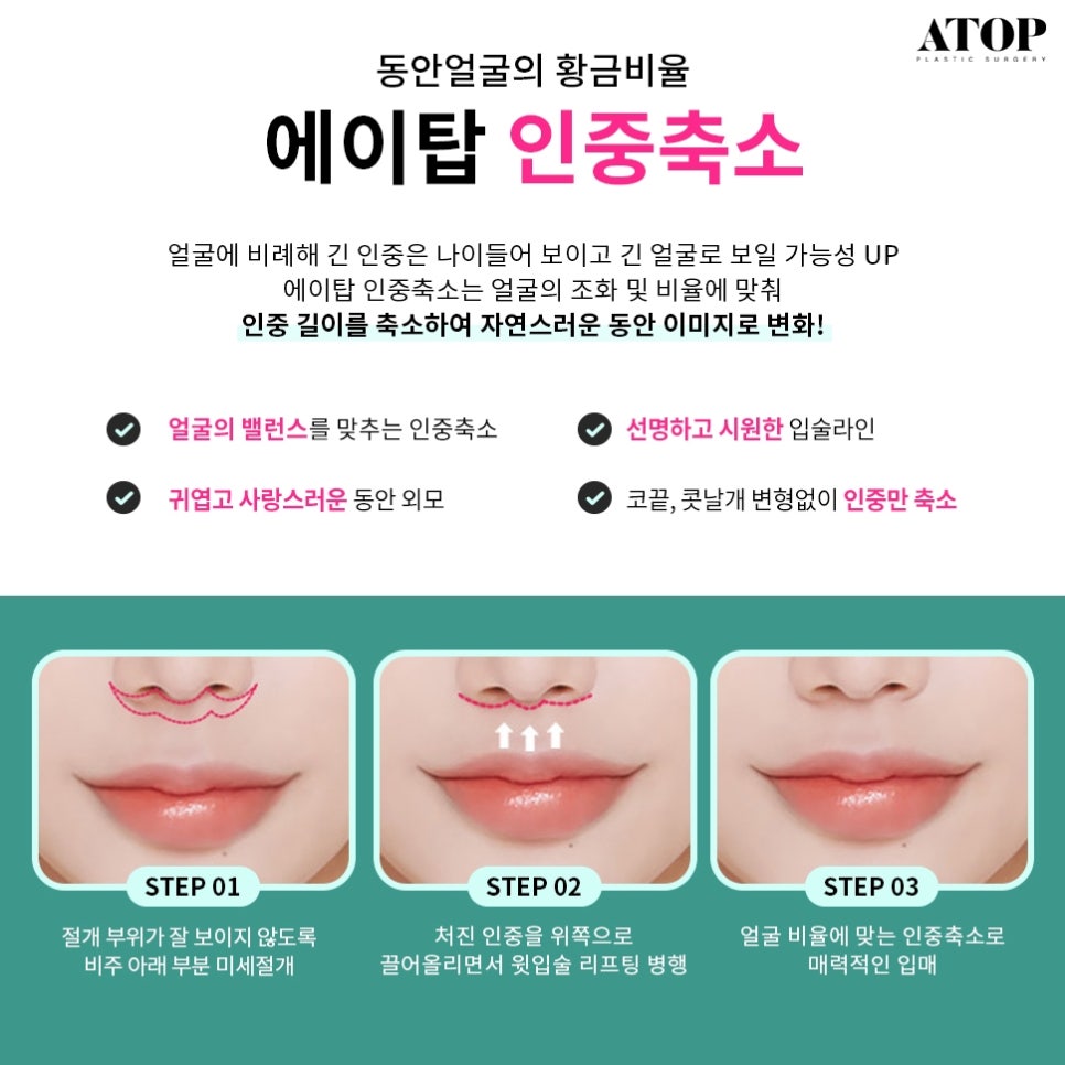 Gangnam Mouth Corner Surgery So Your Lips Match the Look You Want image 5