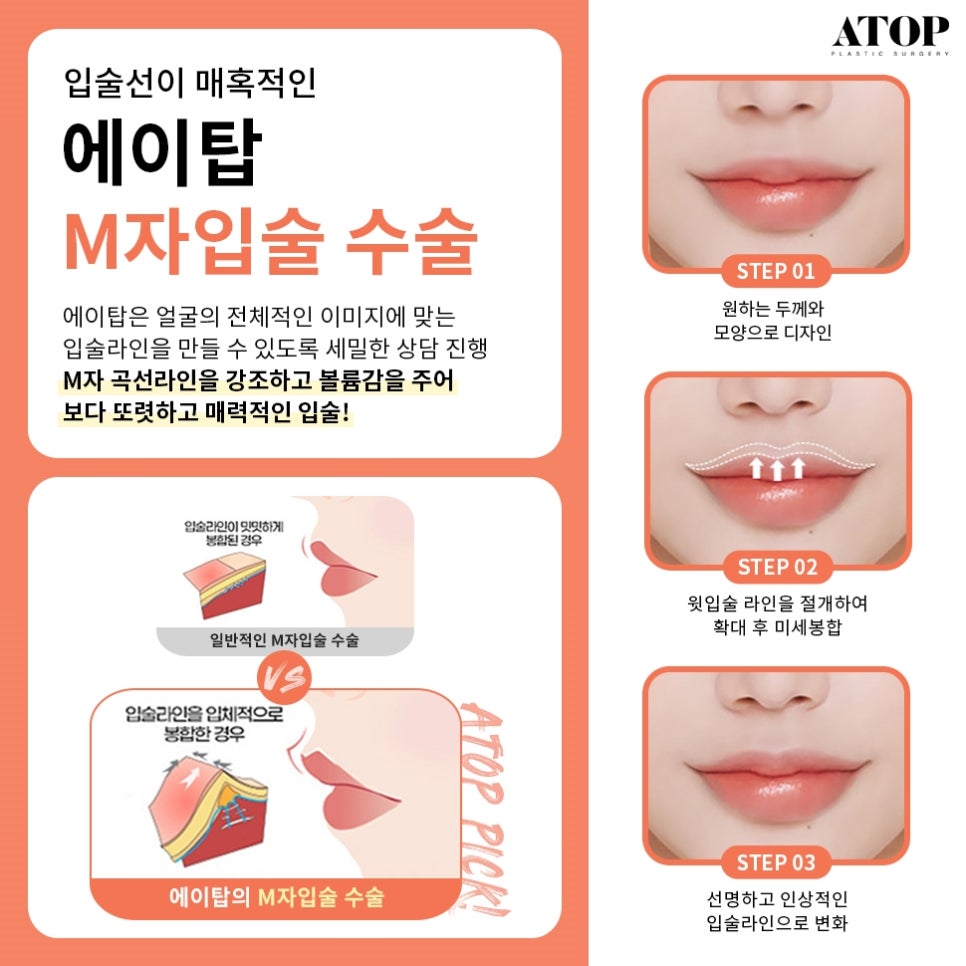 인중축소후기 비율에 맞는 예쁜 입술라인을 위해 관련 이미지 5