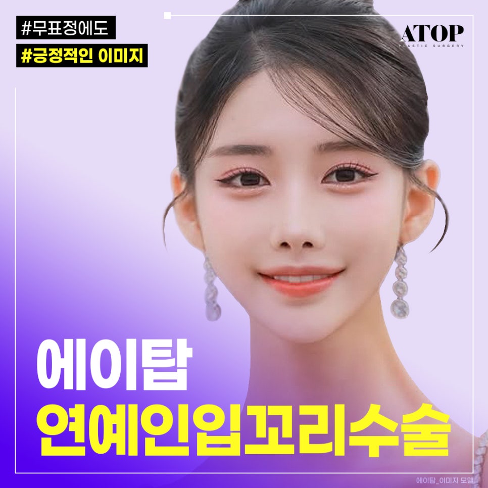 Celebrity Lip Corner Surgery, No Joker Lips: Regaining a Natural Smile image 1