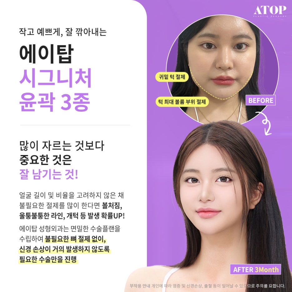 윤곽3종후기 진짜 만족하는 이유 관련 이미지 2