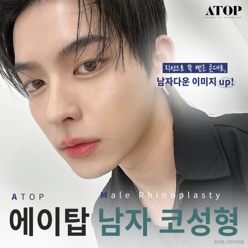 Male Nose Surgery Review: A Natural Line That Doesn’t Look Artificial image 1