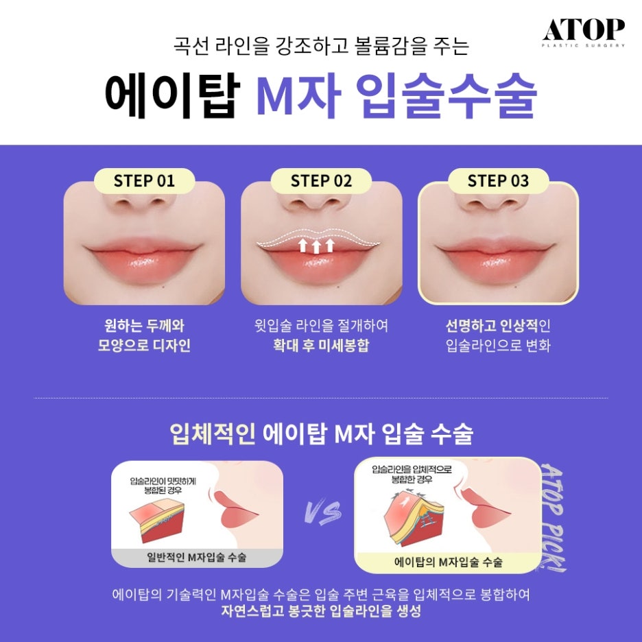 인중축소재수술 비율에 맞는 디자인으로 관련 이미지 6