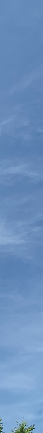눈밑하안검수술 눈밑처짐까지 고민된다면? 관련 이미지 27