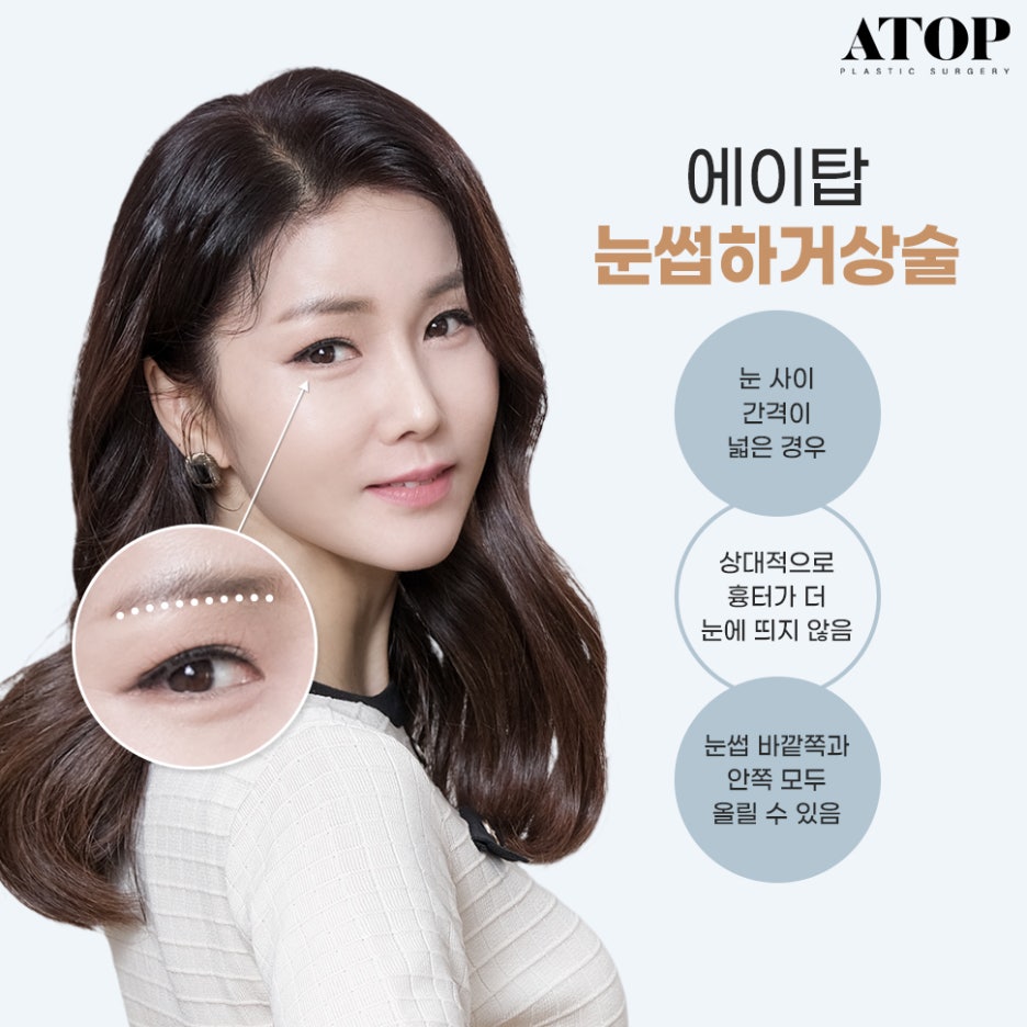 중년눈밑지방 눈꺼풀이 계속 처진다면? 관련 이미지 4