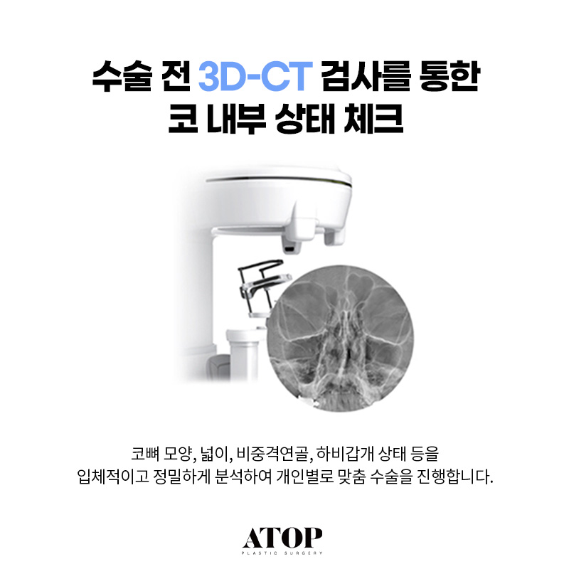 기능코성형수술로 해결할 수 있는 질환은? 관련 이미지 6