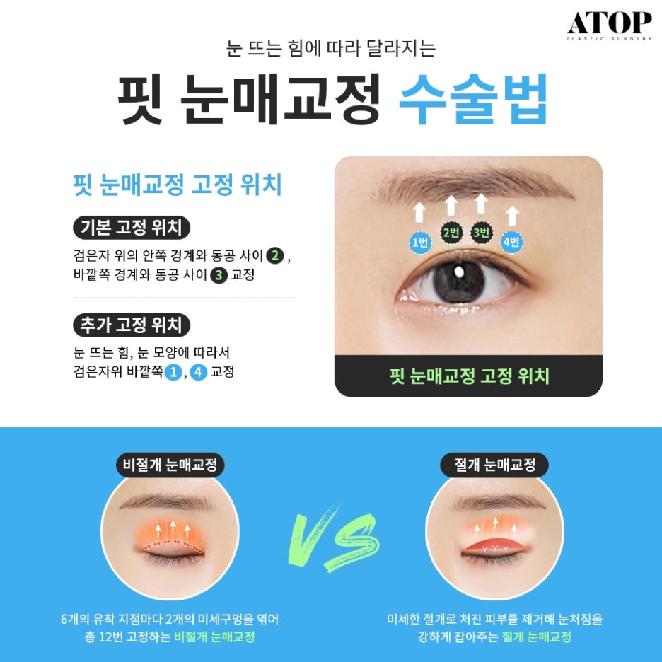 세미아웃라인자연유착 화려함과 자연스러움을 함께 관련 이미지 6