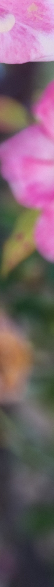 인중축소후기 비율에 맞는 예쁜 입술라인을 위해 관련 이미지 25