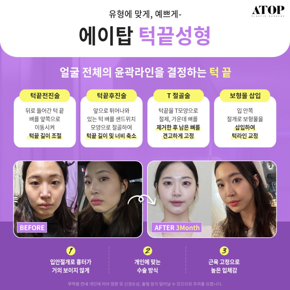 윤곽3종후기 진짜 만족하는 이유 관련 이미지 5