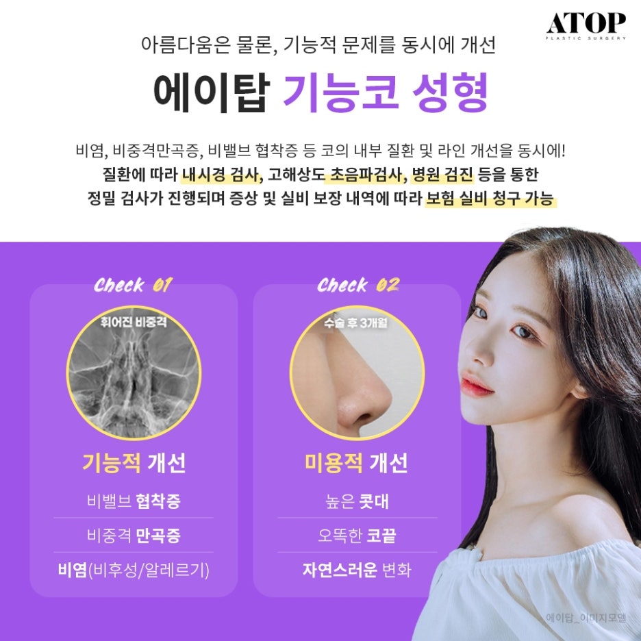 매부리코수술후기 내게 맞는 코 모양을 찾아 관련 이미지 4