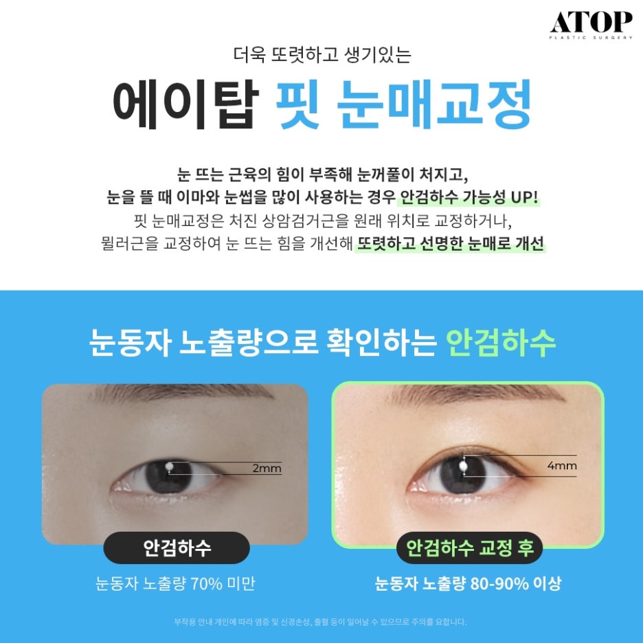세미아웃라인자연유착 화려함과 자연스러움을 함께 관련 이미지 5