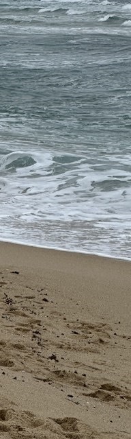 인중코성형후기 내 코에 맞는 핏한 수술 관련 이미지 20
