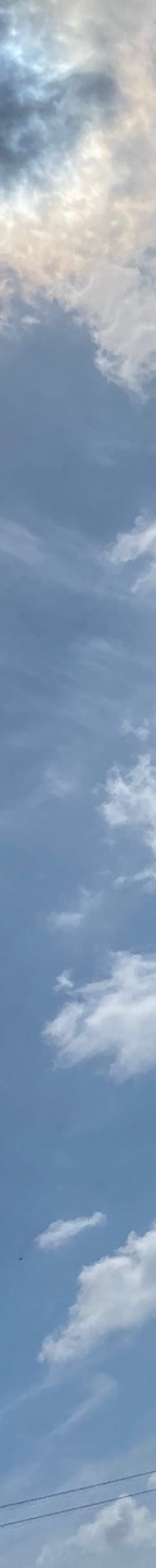 쌍수재수술가격 자연스러운 눈으로 관련 이미지 11