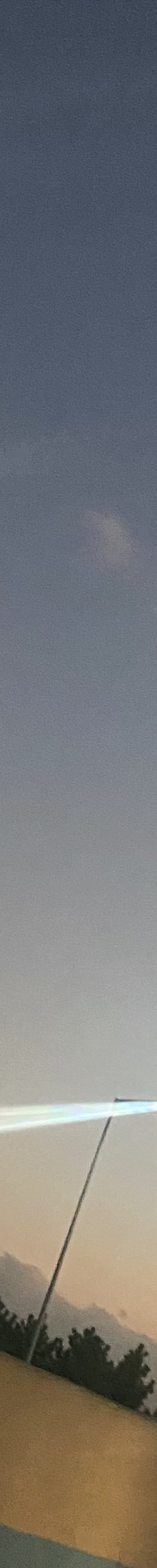 인중축소수술후기 최대 줄일 수 있는 길이는? 관련 이미지 24