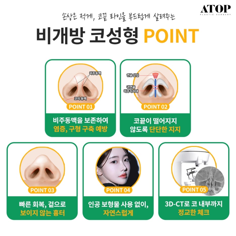 비개방코수술 드러나지 않는 절개선으로 자연스러움 up 관련 이미지 4