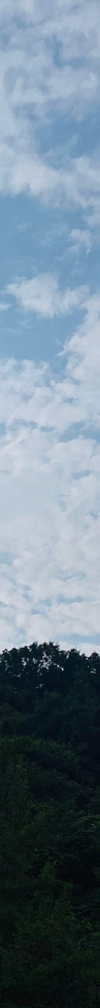 중년눈밑지방 눈꺼풀이 계속 처진다면? 관련 이미지 28