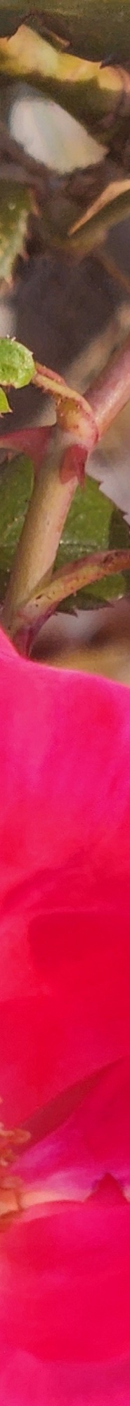 Gangnam Mouth Corner Surgery So Your Lips Match the Look You Want image 15