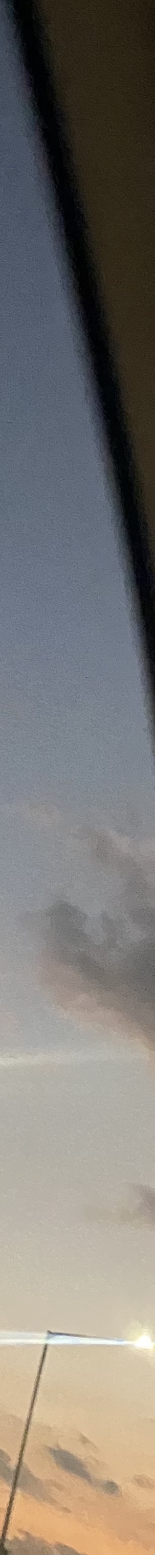 인중축소수술후기 최대 줄일 수 있는 길이는? 관련 이미지 28