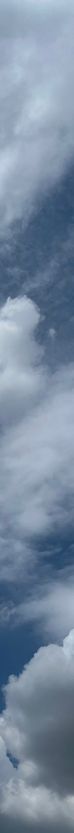 자가늑코성형후기 좋은 코수술 결과의 만족을 높이기 위한 선택 관련 이미지 27