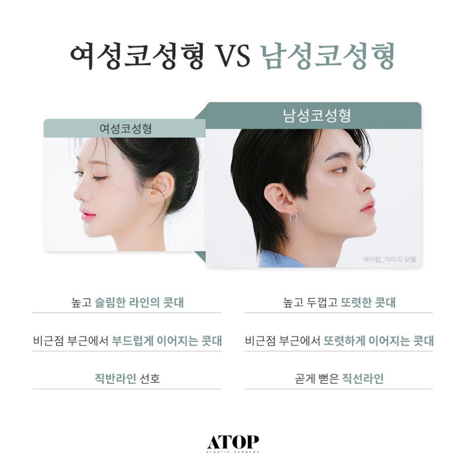 남자코성형잘하는곳 옆라인 살리는 자연스러움 관련 이미지 2
