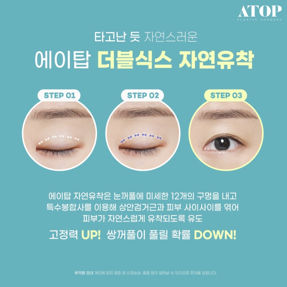 자연유착쌍수후기 인아웃라인 만들기 관련 이미지 4
