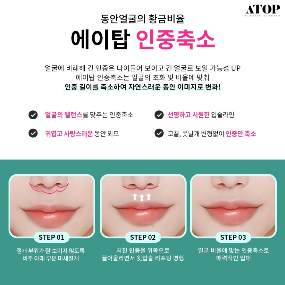 강남인중축소수술 또렷한 옆라인 관련 이미지 5