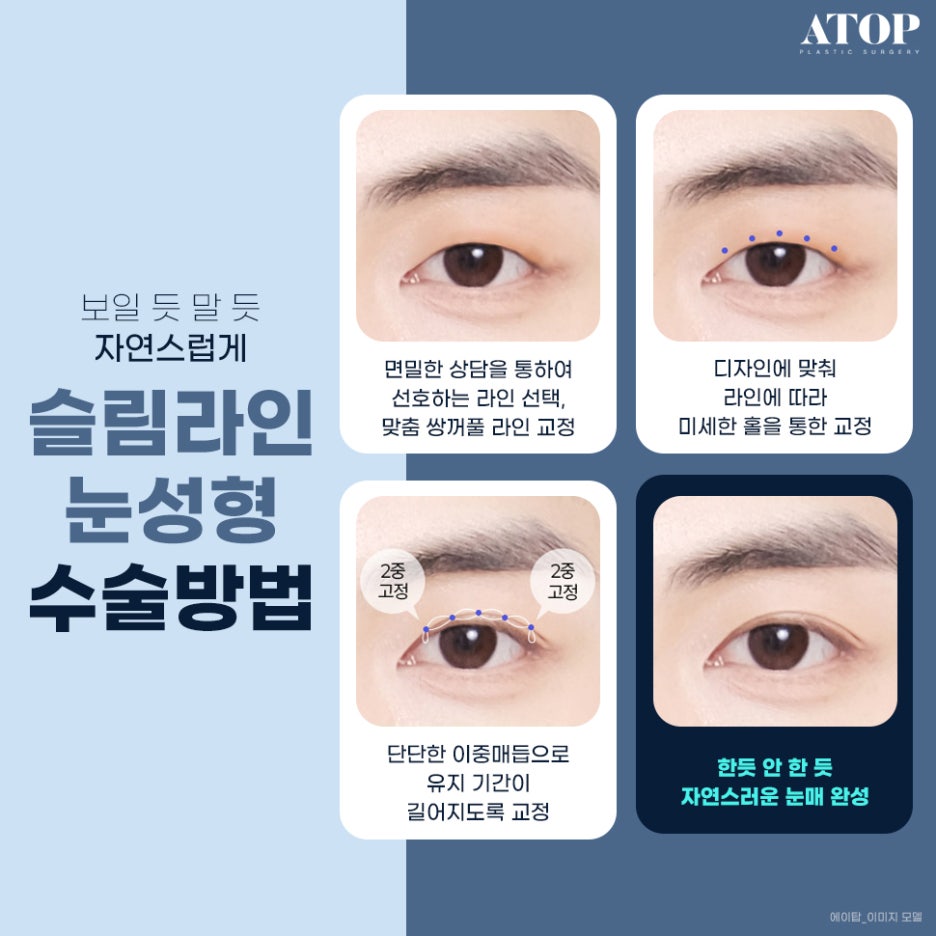 남자눈코성형 티 나지 않게 하는 것이 관건 관련 이미지 6
