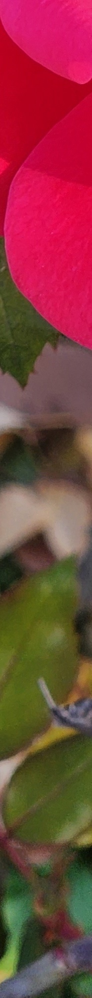 Double Eyelid Revision Surgery, My Own Money, Final Eye Plastic Surgery image 17