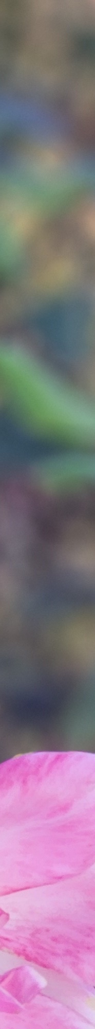 인중축소후기 비율에 맞는 예쁜 입술라인을 위해 관련 이미지 15