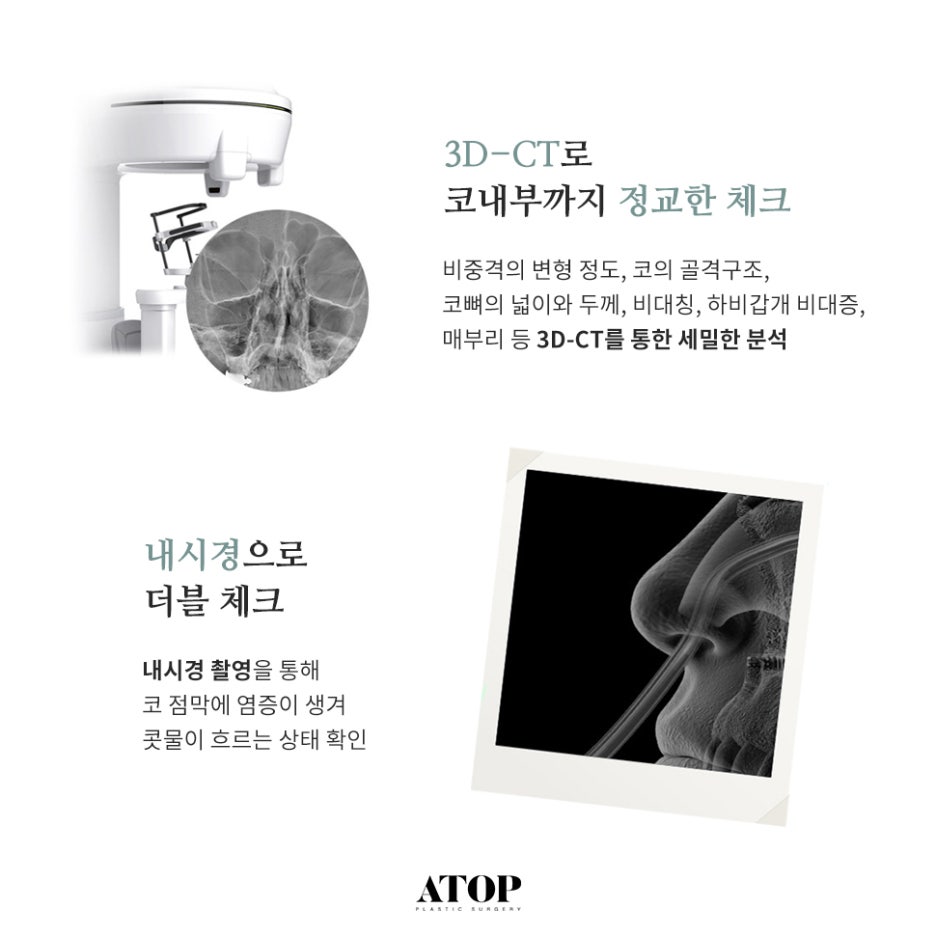 남자코성형잘하는곳 옆라인 살리는 자연스러움 관련 이미지 4