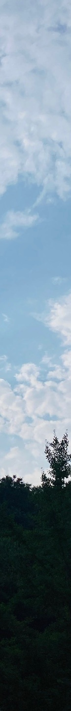 중년눈밑지방 눈꺼풀이 계속 처진다면? 관련 이미지 26