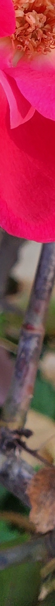Double Eyelid Revision Surgery, My Own Money, Final Eye Plastic Surgery image 19
