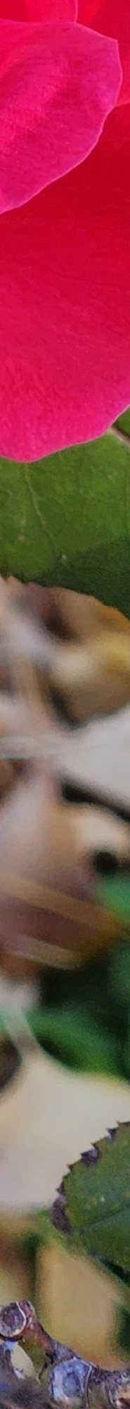 Double Eyelid Revision Surgery, My Own Money, Final Eye Plastic Surgery image 22