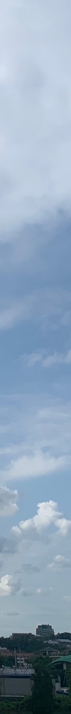 코재수술병원 변형된 코 원래 모습대로 관련 이미지 16