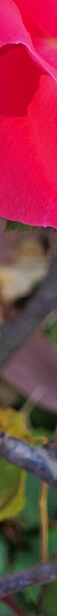Double Eyelid Revision Surgery, My Own Money, Final Eye Plastic Surgery image 18