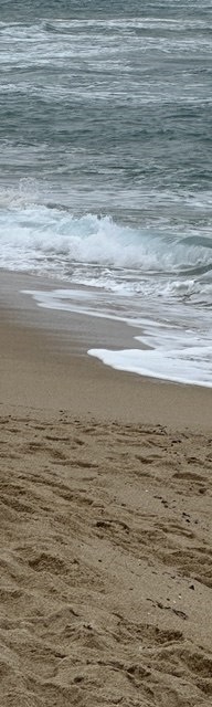 인중코성형후기 내 코에 맞는 핏한 수술 관련 이미지 19