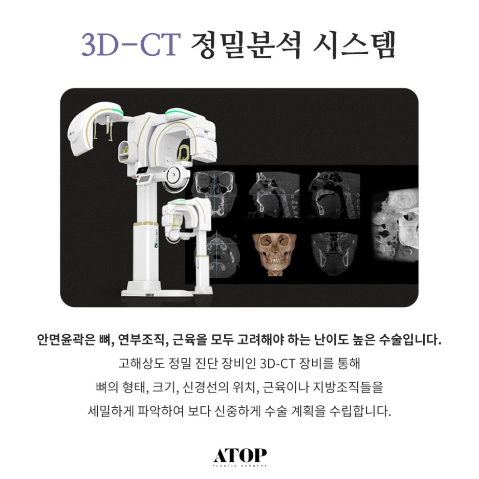 무턱보형물수술 자연스럽게 이어지는 윤곽 라인 관련 이미지 4
