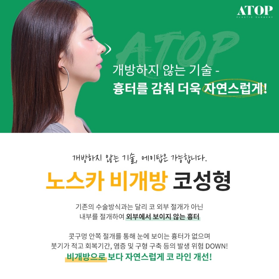 비개방코수술 드러나지 않는 절개선으로 자연스러움 up 관련 이미지 2