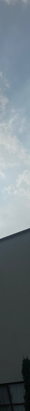 인중축소후기 인중 길이 고민 해소 관련 이미지 28