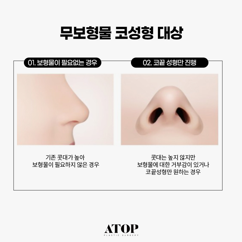 무보형물 코성형 만족도가 떨어질까? 관련 이미지 2